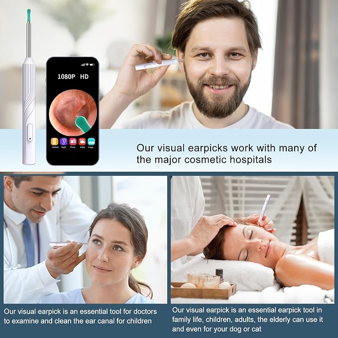 Ear Wax Removal Tool, Ear Cleaner with1080P HD Otoscope Camera, Ear Camera - Image 7