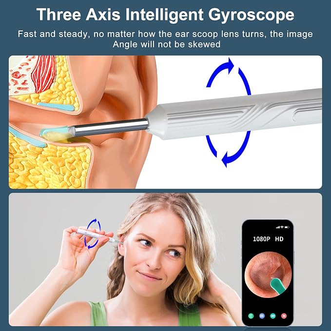Ear Wax Removal Tool, Ear Cleaner with1080P HD Otoscope Camera, Ear Camera - Image 5