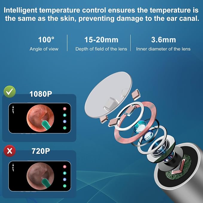 Ear Wax Removal Tool, Ear Cleaner with1080P HD Otoscope Camera, Ear Camera - Image 2