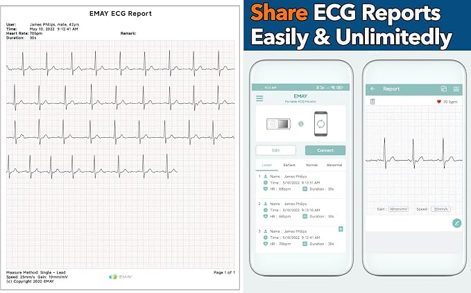 EMAY Portable ECG Monitor | Record ECG and Heart Rate | Compatible - Image 3
